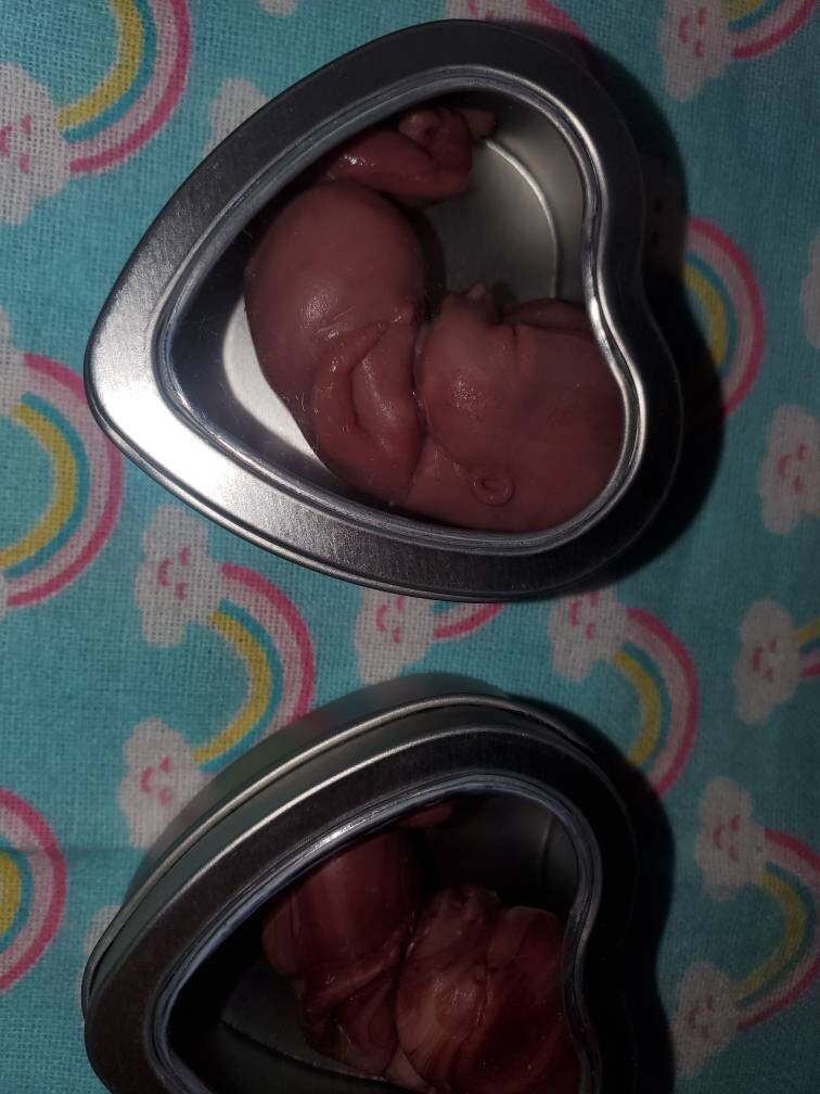 13 week gestational fetus memorial baby tin heart