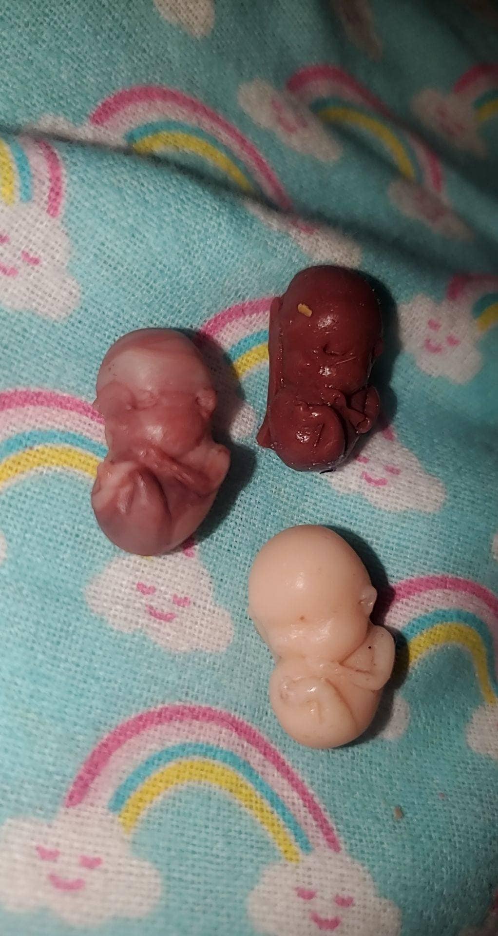9 week old fetus baby memorial baby