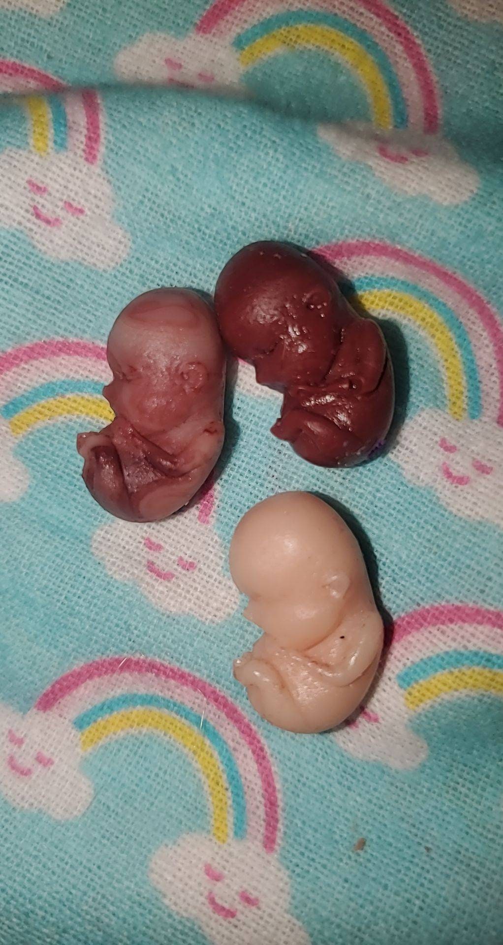 9 week old fetus baby memorial baby