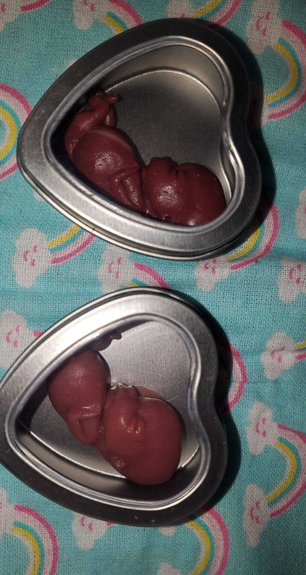 12 week gestation fetus baby memorial baby in tin heart keepsake