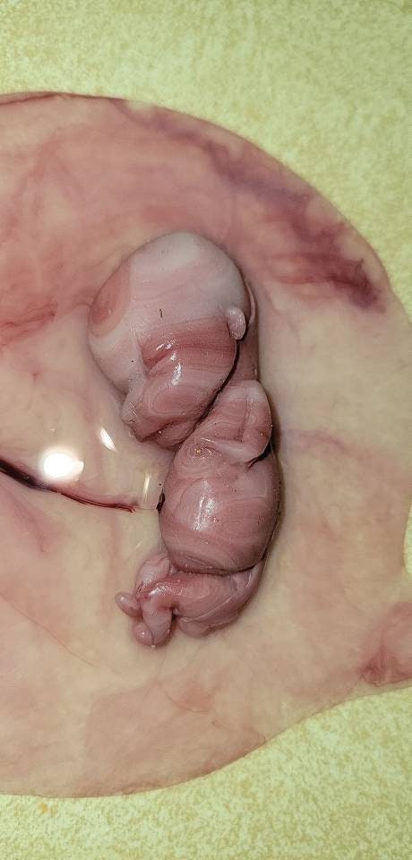 12 week gestational fetus silicone memorial baby inside silicone womb with placenta attached
