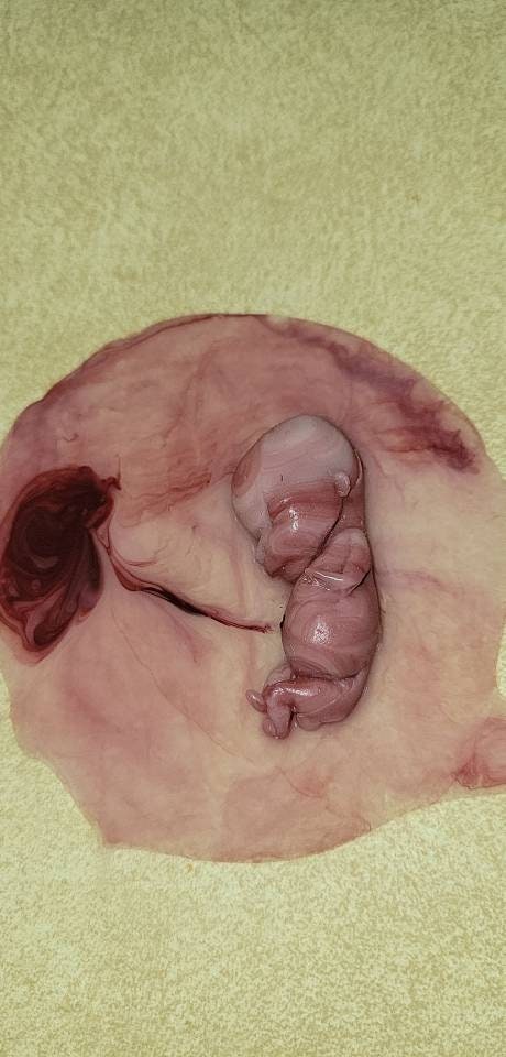 12 week gestational fetus silicone memorial baby inside silicone womb with placenta attached