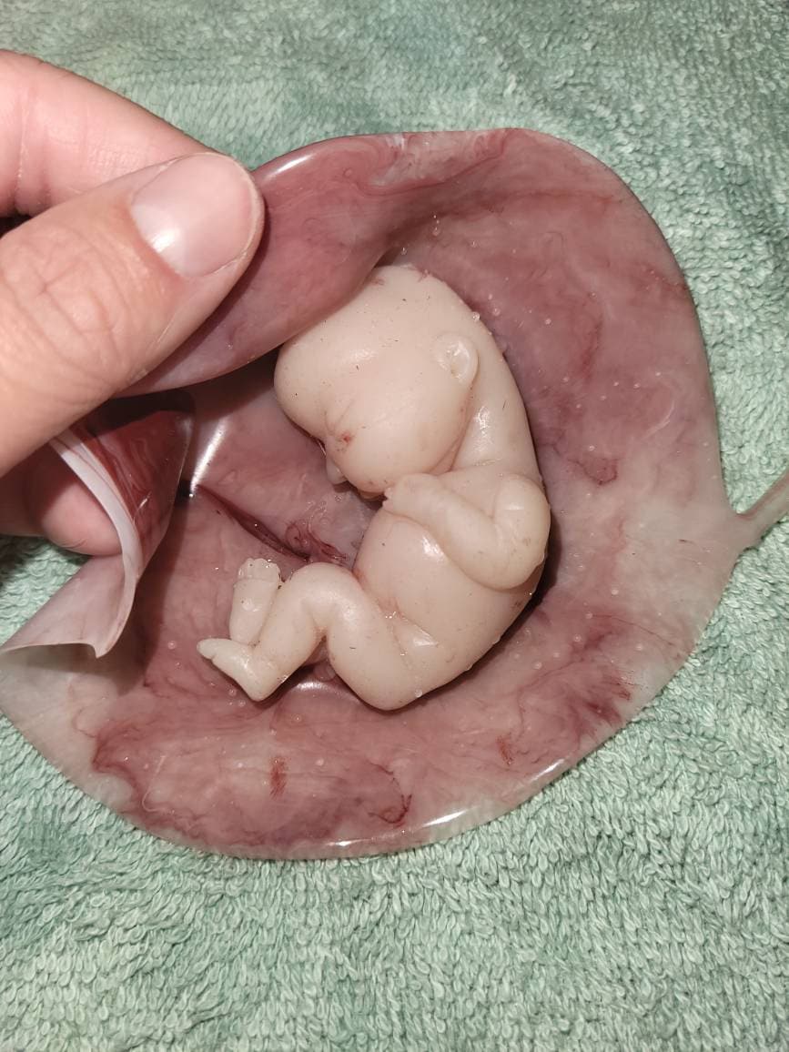 17 week gestation fetus memorial silicone baby in silicone womb with placenta