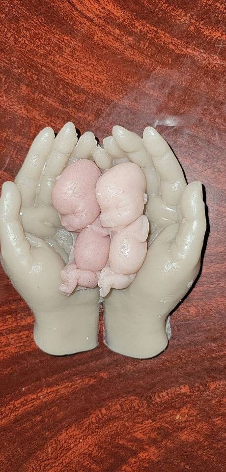 12 week gestational fetus memorial baby in hands