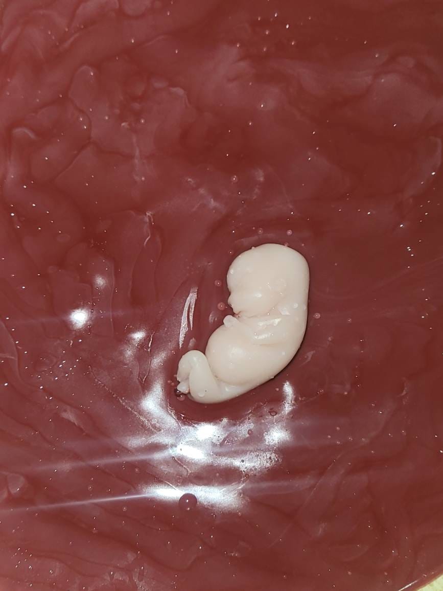 10 week gestational silicone memorial baby fetus inside silicone womb keepsake