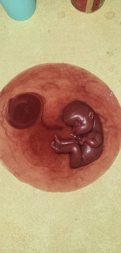 18 week gestation silicone baby in womb with placenta