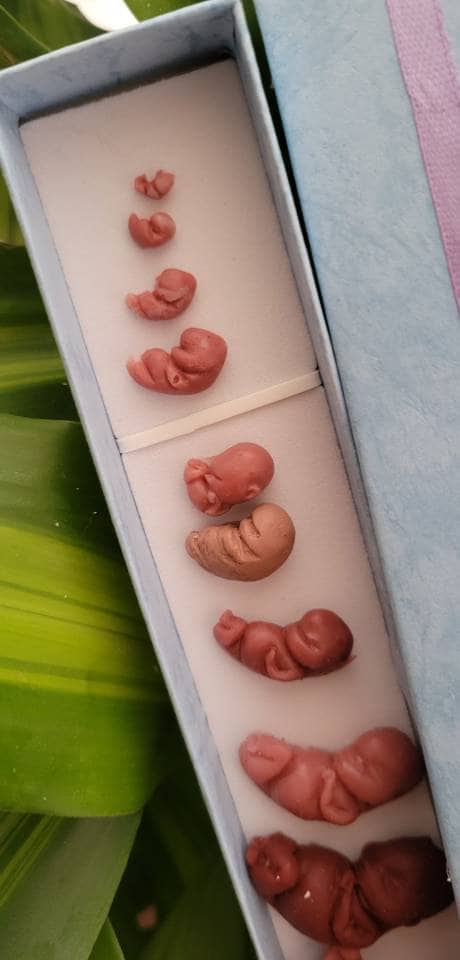 9b975b63-e6d3-4598-a40a-a59bbfdb58bc