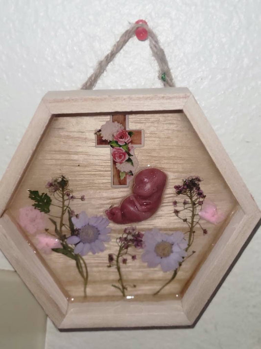 Ready to ship 11 week silicone fetus in beautiful wood frame with resin back drop