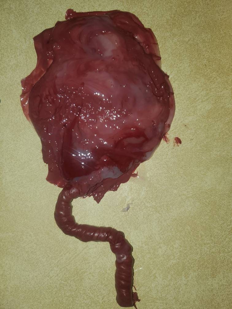 warning graphic** Silicone placenta and umbilical cord for silicone baby