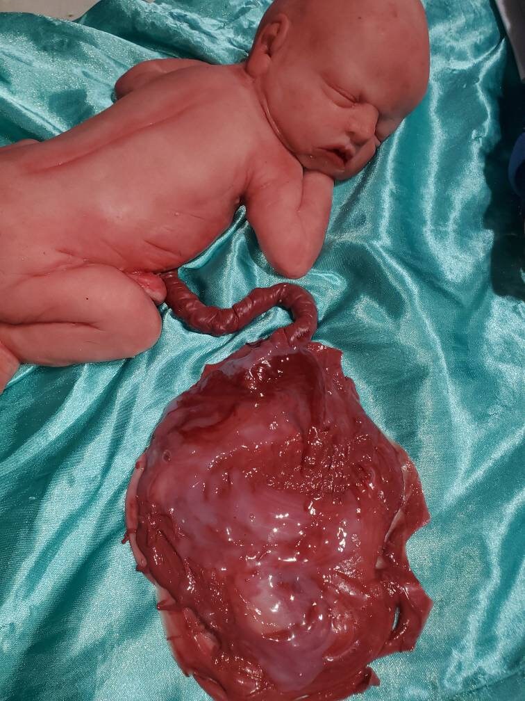warning graphic** Silicone placenta and umbilical cord for silicone baby