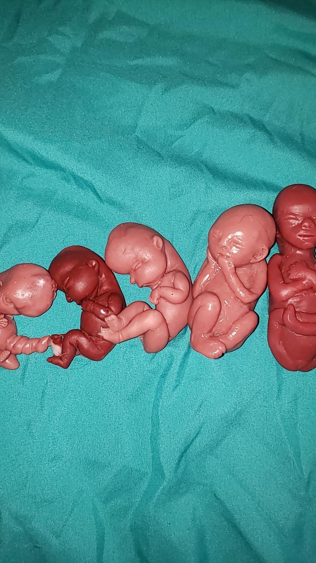 Silicone baby fetus LOT pro life developmental bundle of babies
