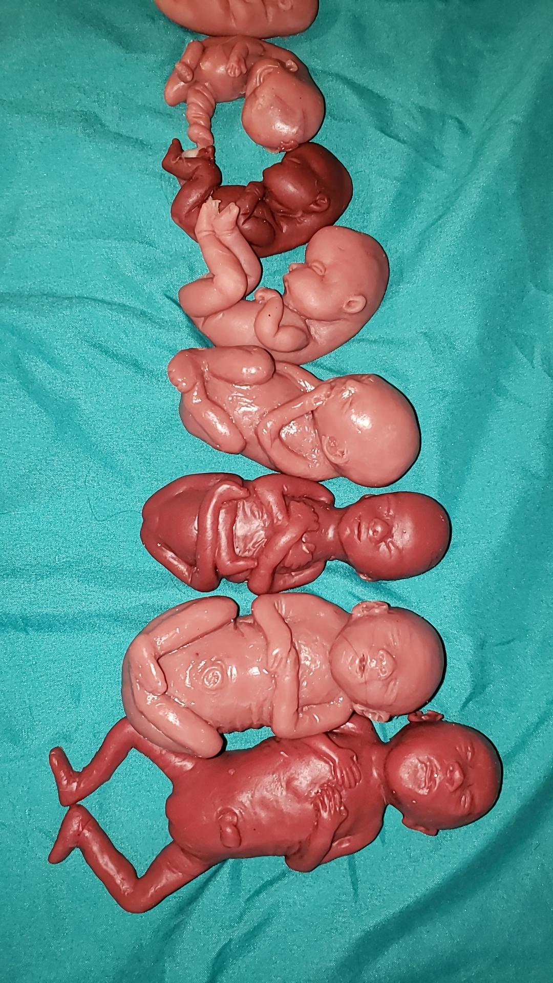 Silicone baby fetus LOT pro life developmental bundle of babies