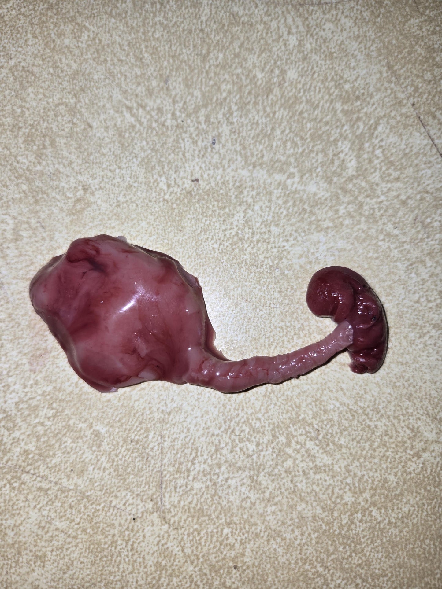 Silicone fetus with placenta and umbilical cord