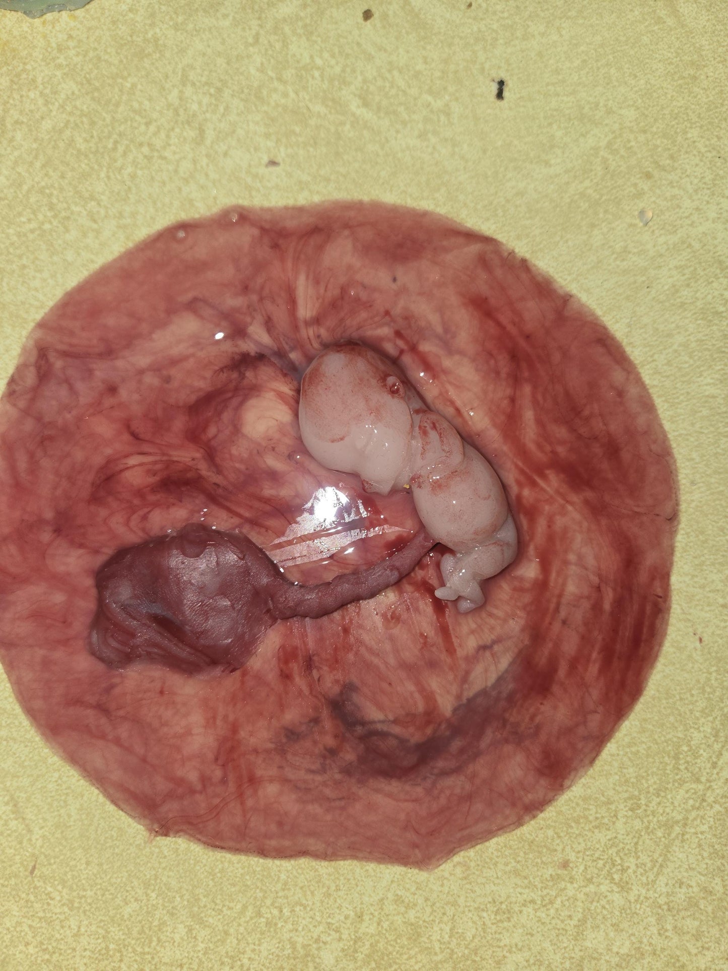 Warning graphic 12 week gestational fetus silicone memorial baby inside silicone womb with placenta attached