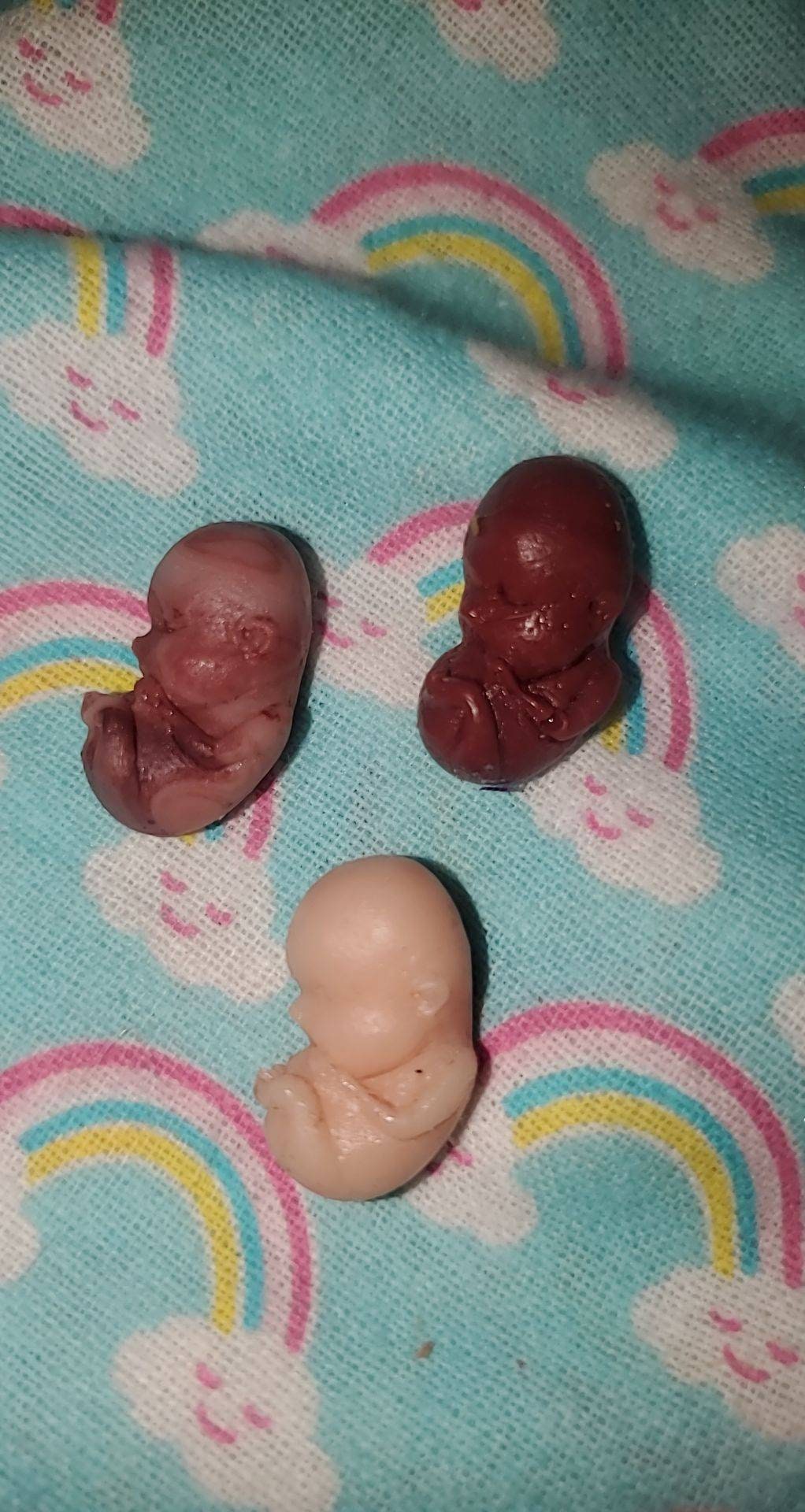 9 week old fetus baby memorial baby