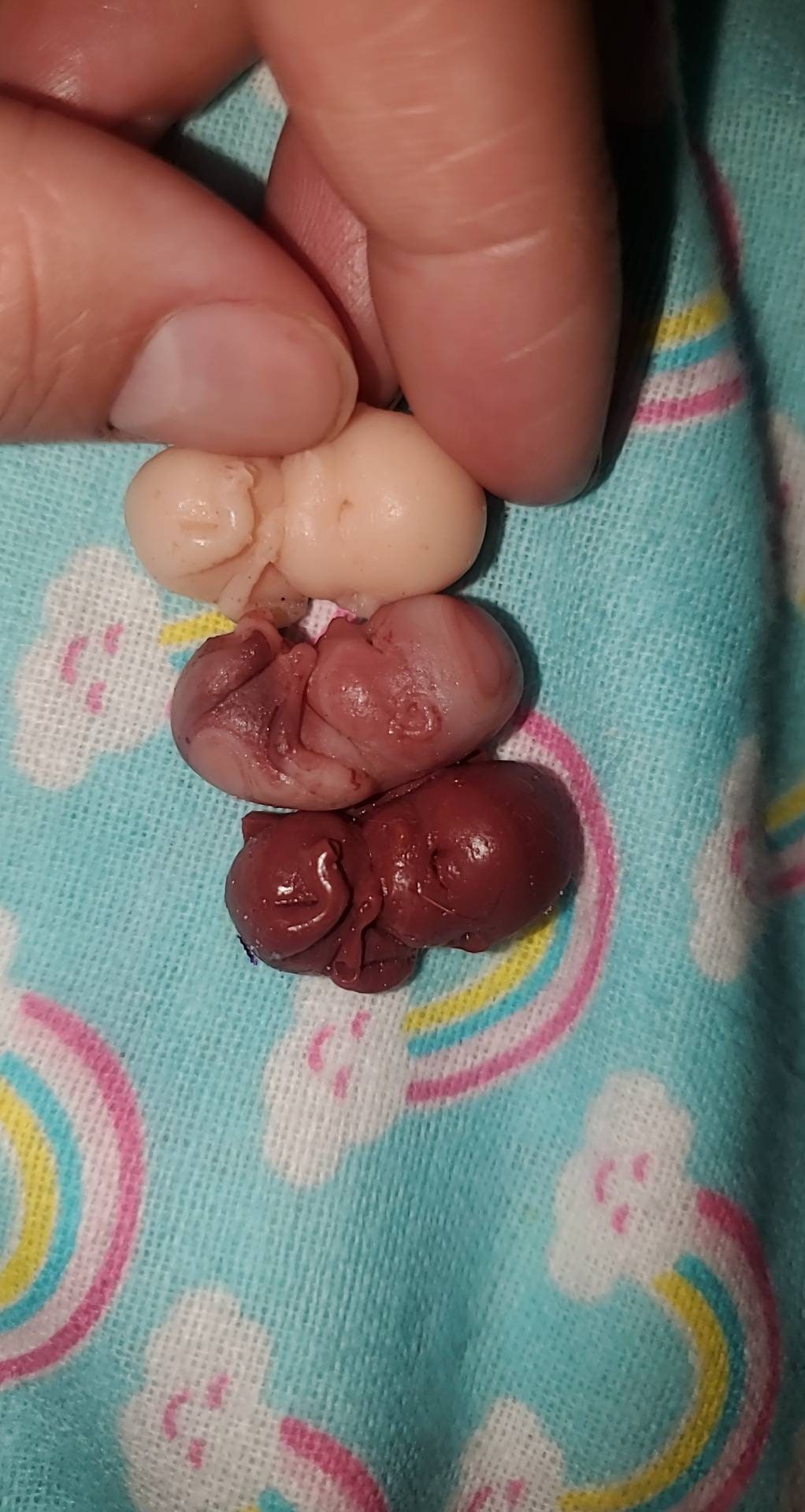 9 week old fetus baby memorial baby