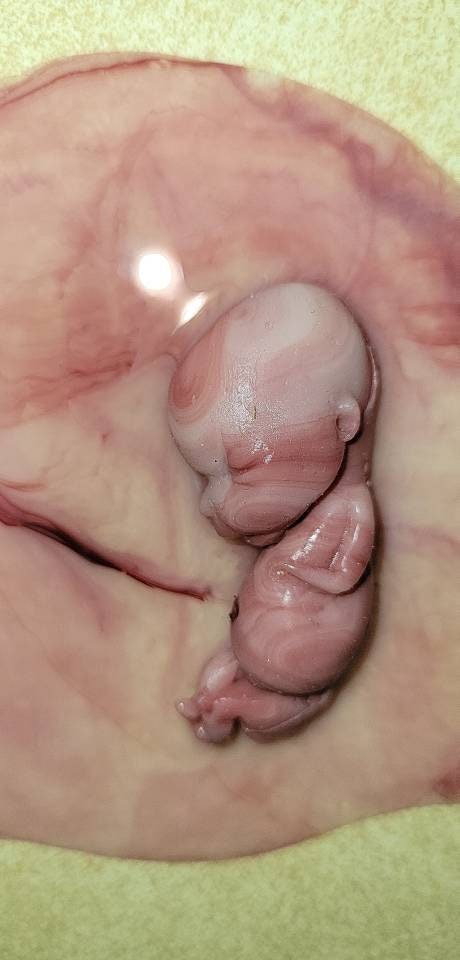 12 week gestational fetus silicone memorial baby inside silicone womb with placenta attached