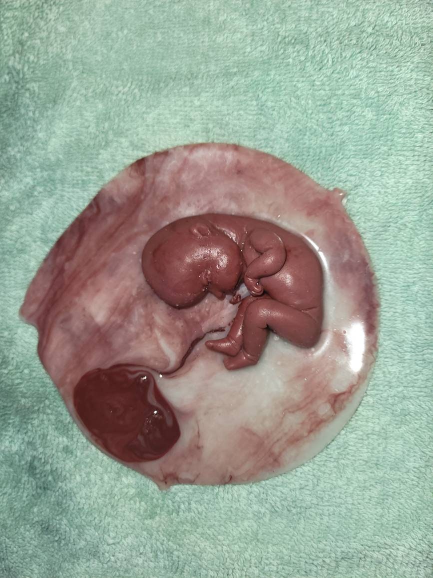 18 week gestation silicone baby in womb with placenta