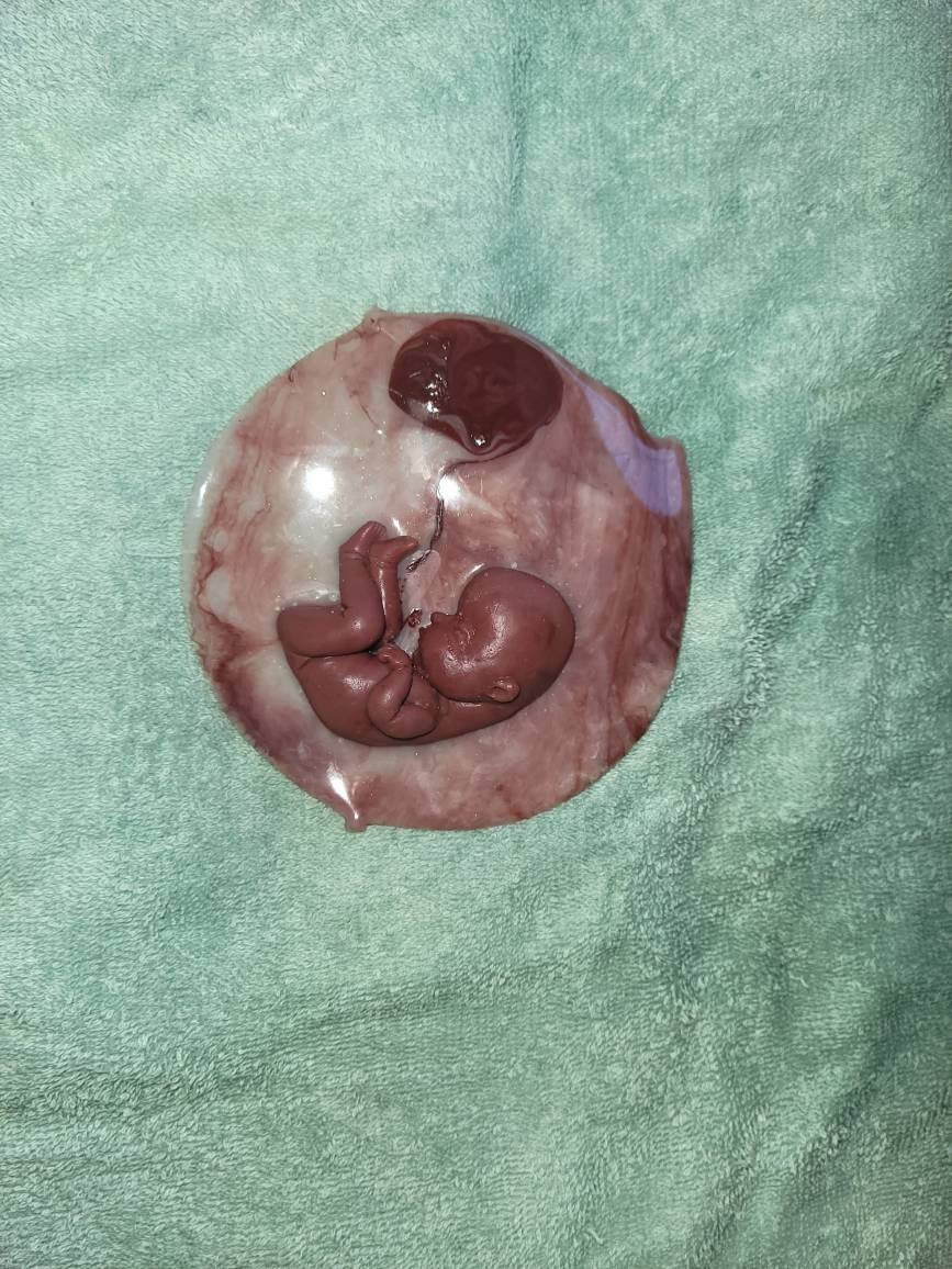 18 week gestation silicone baby in womb with placenta