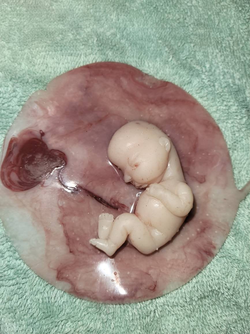17 week gestation fetus memorial silicone baby in silicone womb with placenta