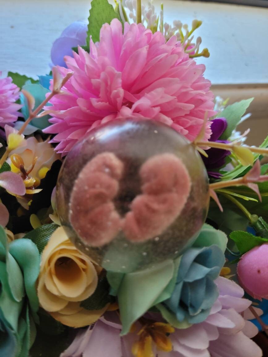 Silicone baby memorial twins inside resin