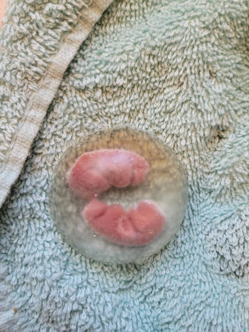 Silicone baby memorial twins inside resin