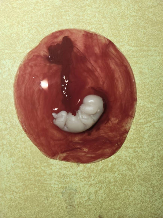 10 week gestational silicone memorial baby fetus inside silicone womb keepsake
