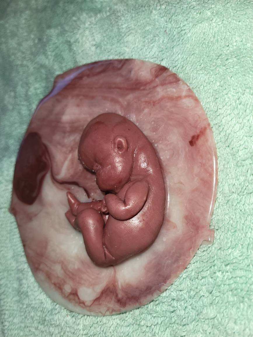 18 week gestation silicone baby in womb with placenta
