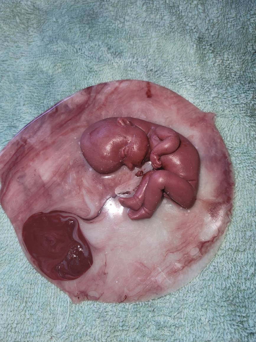 18 week gestation silicone baby in womb with placenta