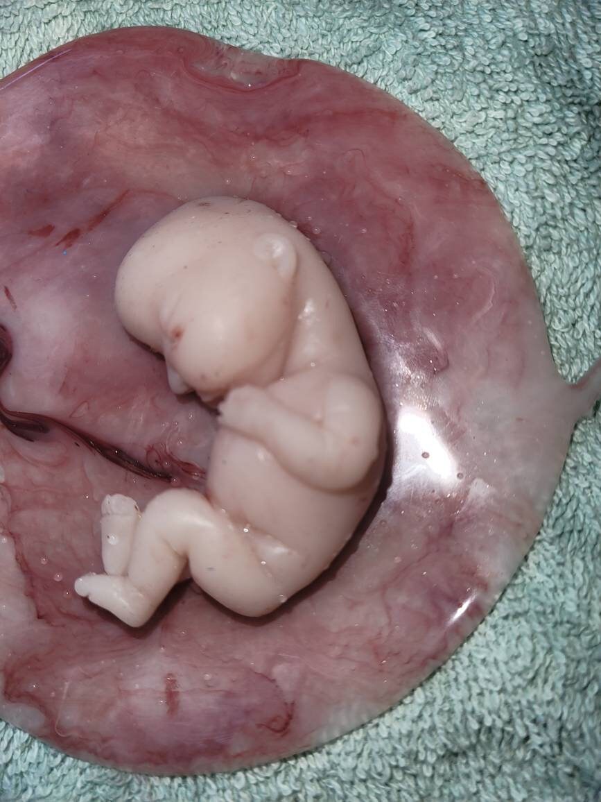 17 week gestation fetus memorial silicone baby in silicone womb with placenta