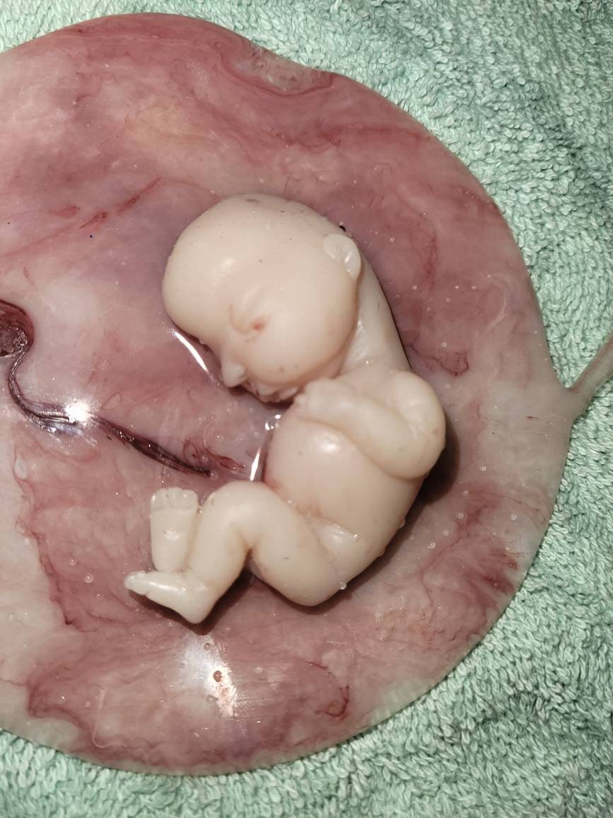 17 week gestation fetus memorial silicone baby in silicone womb with placenta