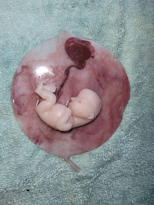 17 week gestation fetus memorial silicone baby in silicone womb with placenta