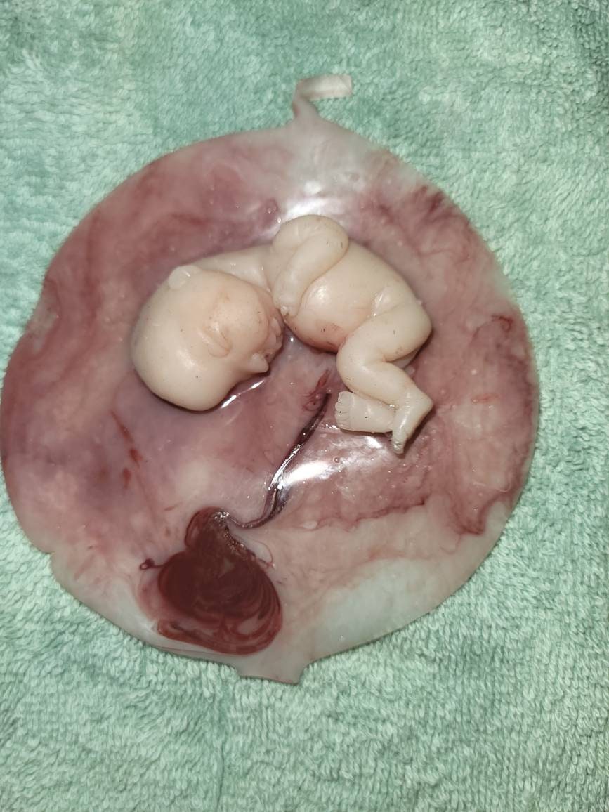 17 week gestation fetus memorial silicone baby in silicone womb with placenta