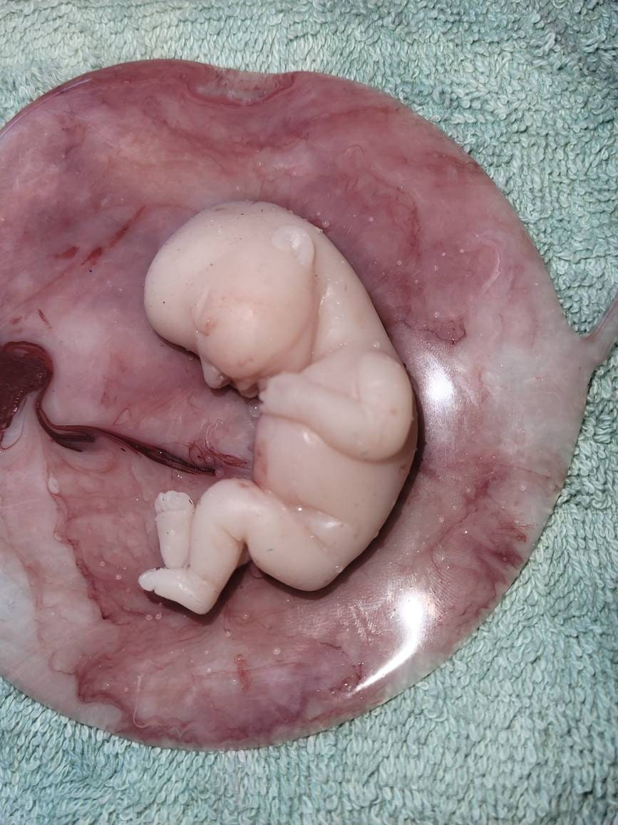 17 week gestation fetus memorial silicone baby in silicone womb with placenta