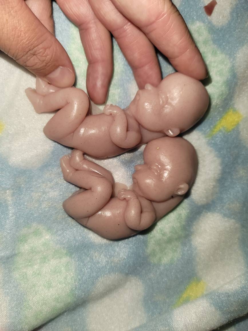 18 week gestational fetus baby born too soon memorial silicone baby