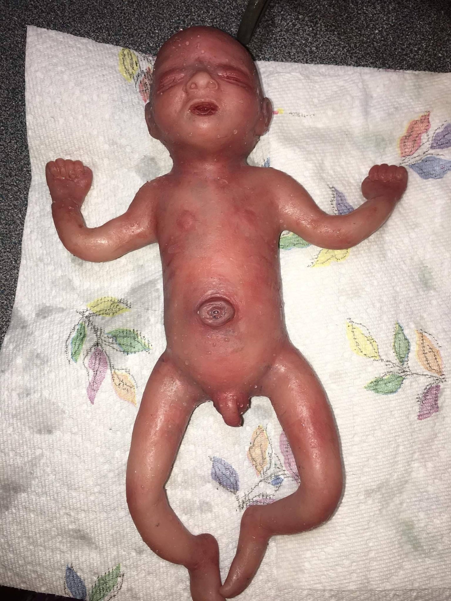 Full Body Silicone Baby 24-25 week gestation 11" marvin