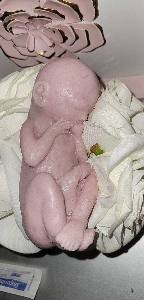 22 week gestational fetus unborn memorial baby