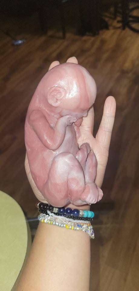 22 week gestational fetus unborn memorial baby