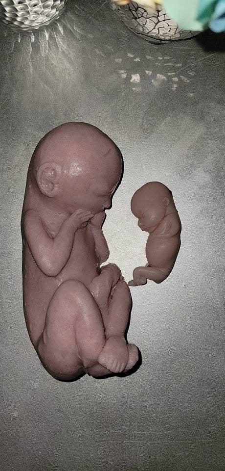 22 week gestational fetus unborn memorial baby
