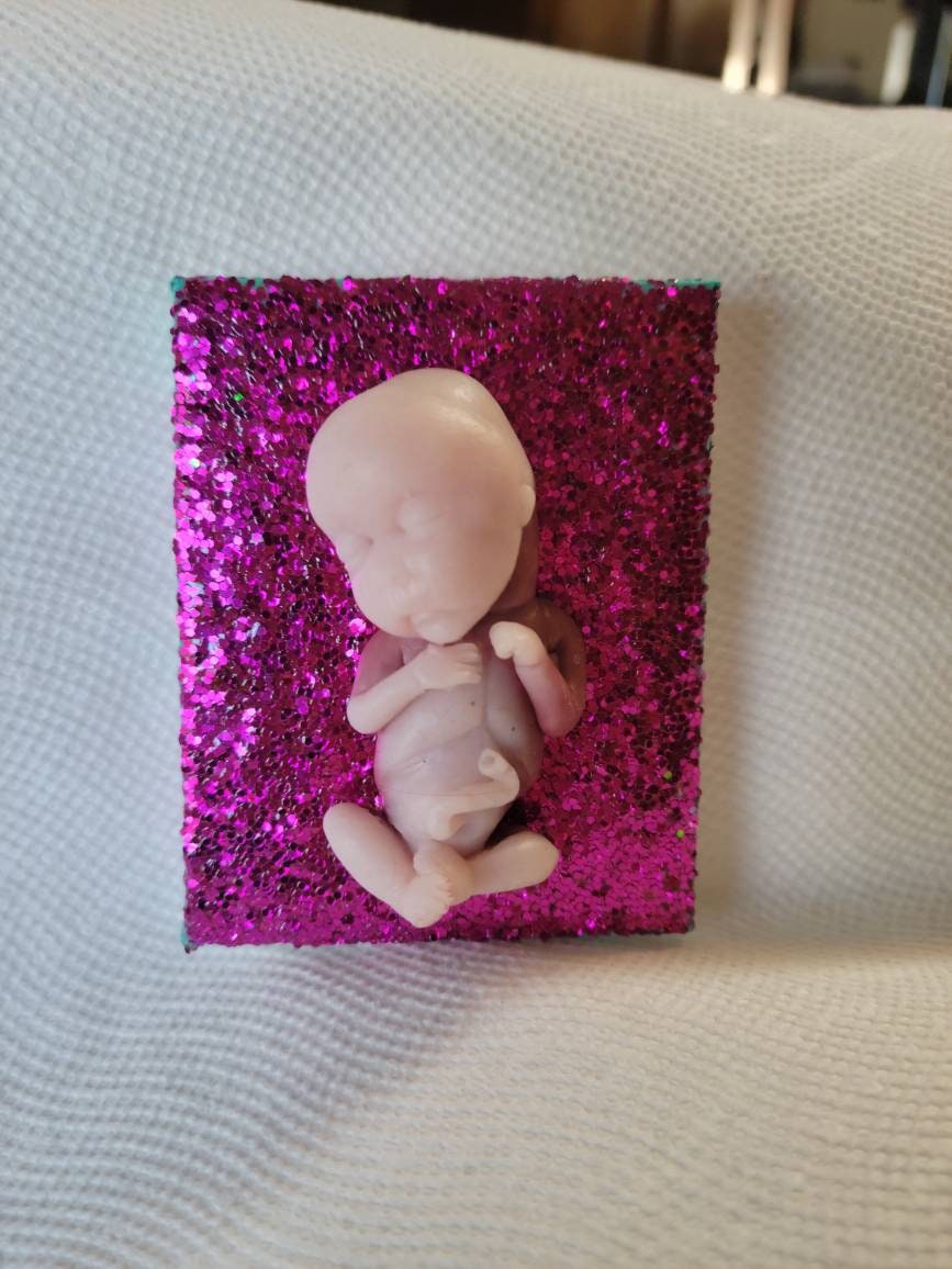 14 week gestational memorial fetus fridge magnet
