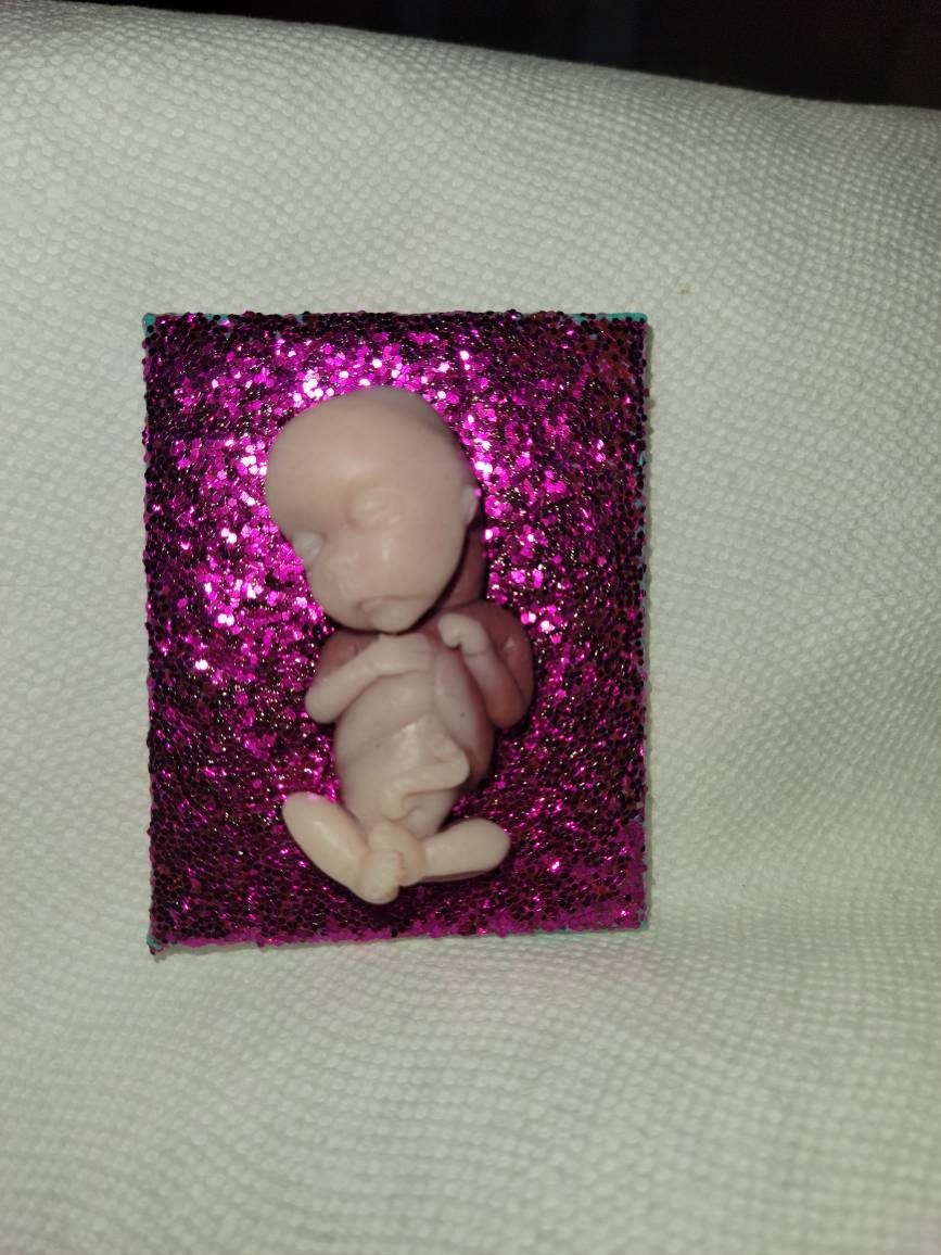 14 week gestational memorial fetus fridge magnet