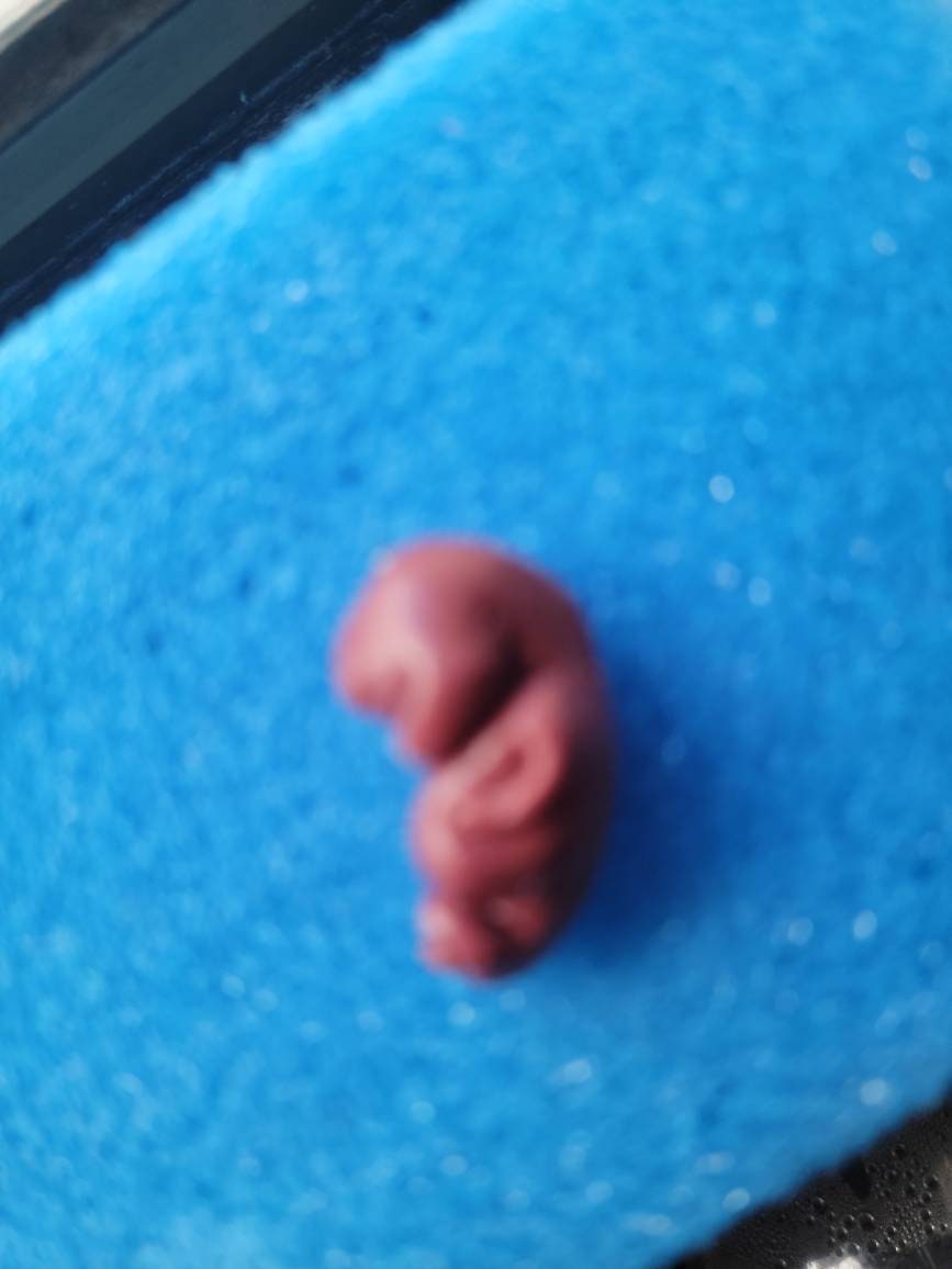 8 week gestational fetus silicone baby