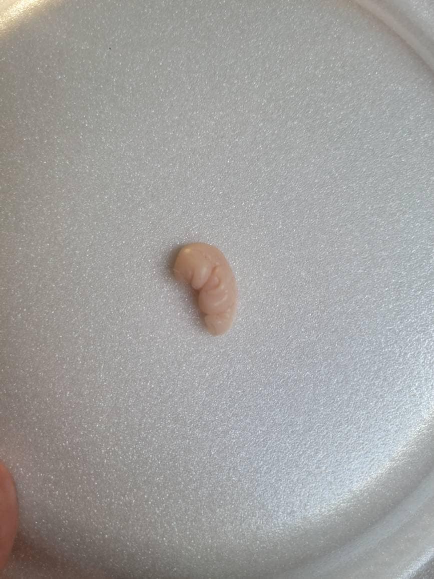 8 week gestational fetus silicone baby