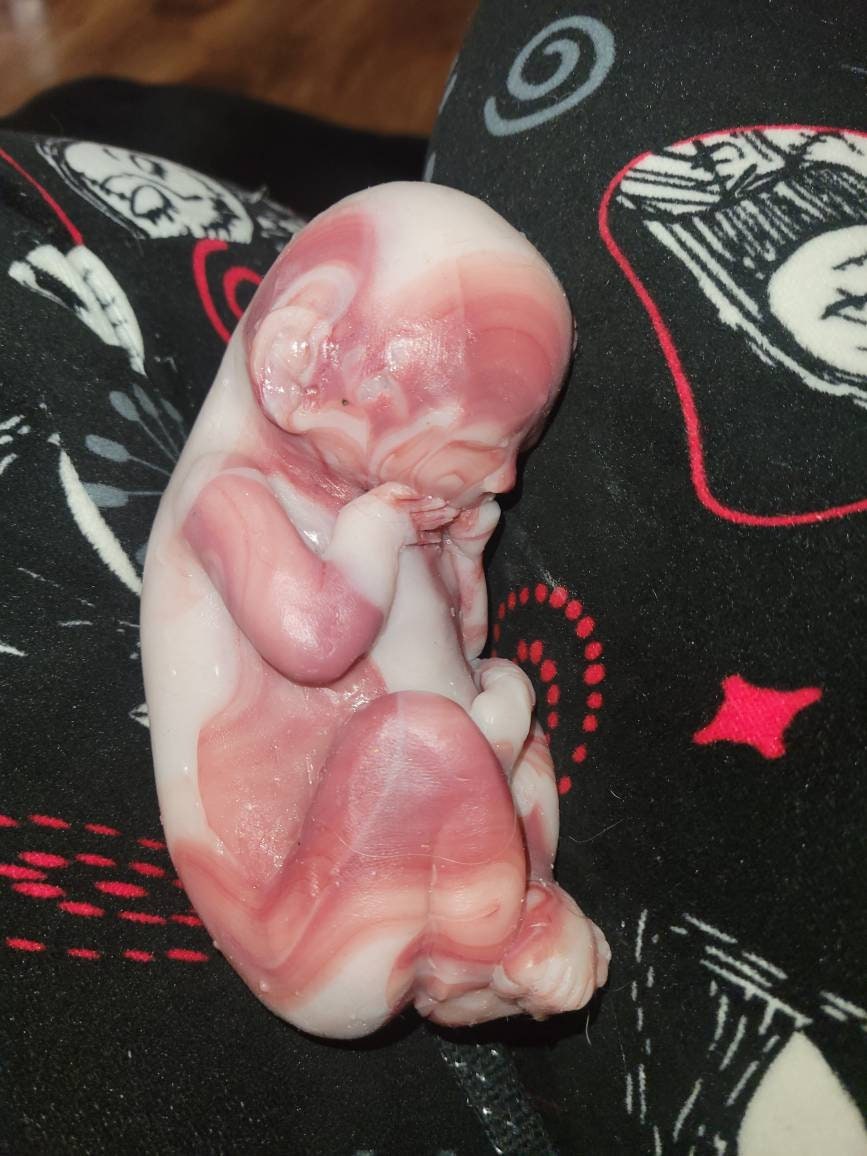 22 week gestational fetus unborn memorial baby