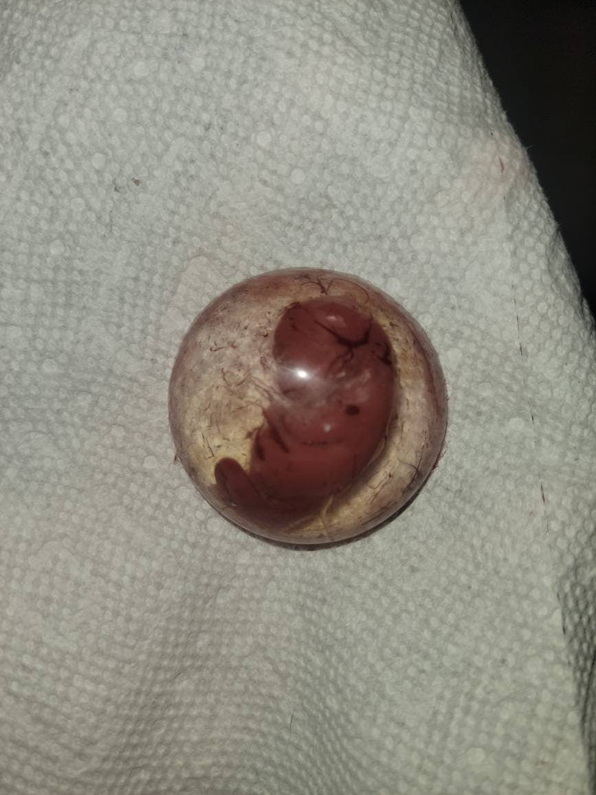 Silicone memorial baby Inside womb