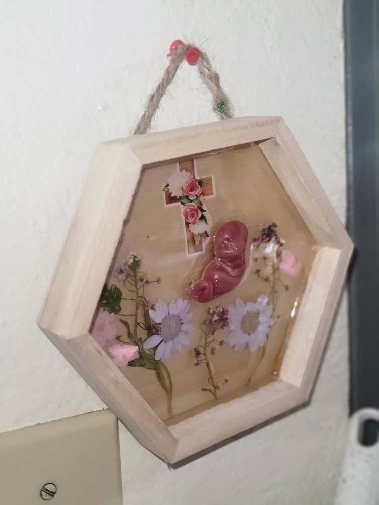 Ready to ship 11 week silicone fetus in beautiful wood frame with resin back drop