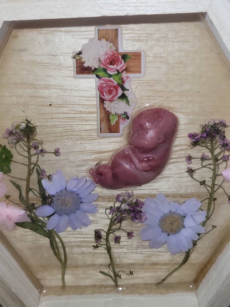 Ready to ship 11 week silicone fetus in beautiful wood frame with resin back drop