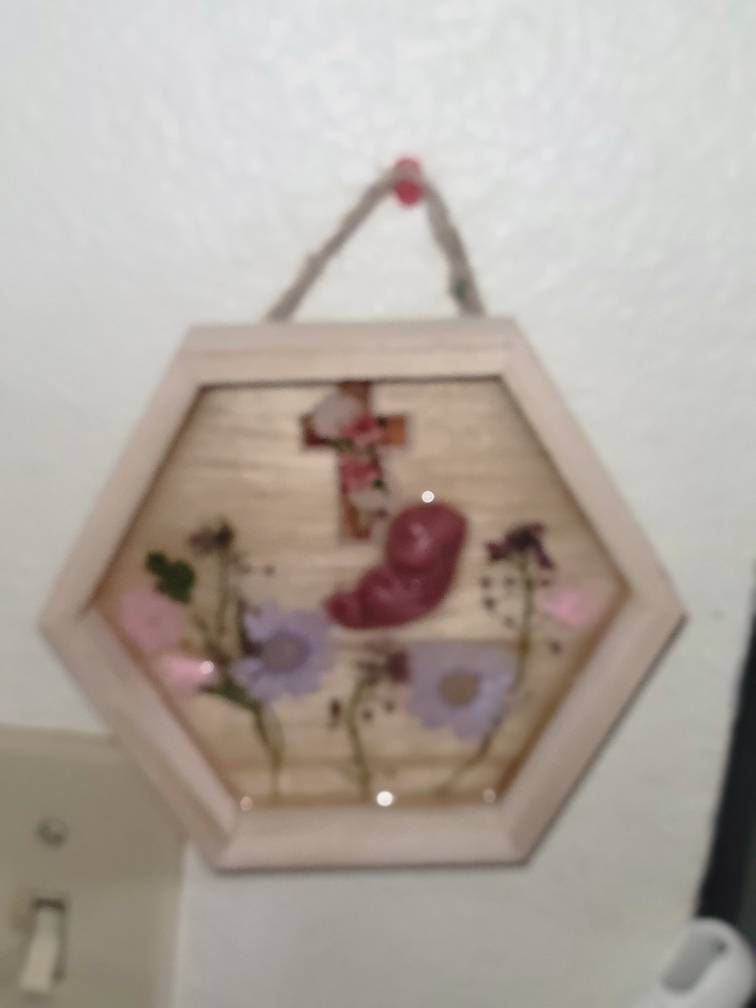 Ready to ship 11 week silicone fetus in beautiful wood frame with resin back drop