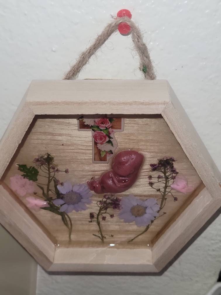 Ready to ship 11 week silicone fetus in beautiful wood frame with resin back drop
