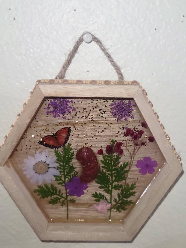 Ready to ship 10 week gestation silicone fetus in Beautiful wood frame with resin back ground